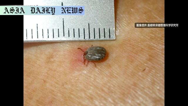Alarming Surge: Japan's SFTS Cases Hit Record High in 2023