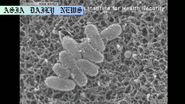 Alarming Surge: Japan Records Highest Whooping Cough Cases in 5 Years
